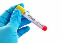 Israel anti-rabies vaccine