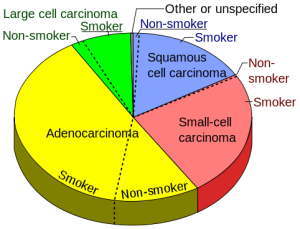 482px-Pie_chart_of_lung_cancers.svg
