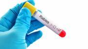 Israel anti-rabies vaccine