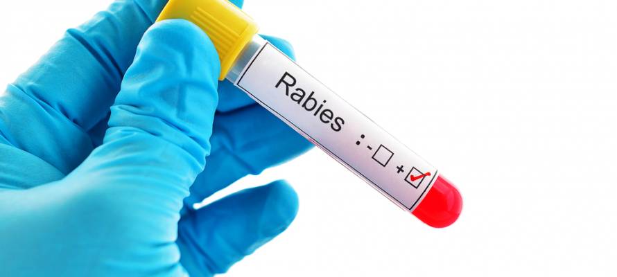 Israel anti-rabies vaccine