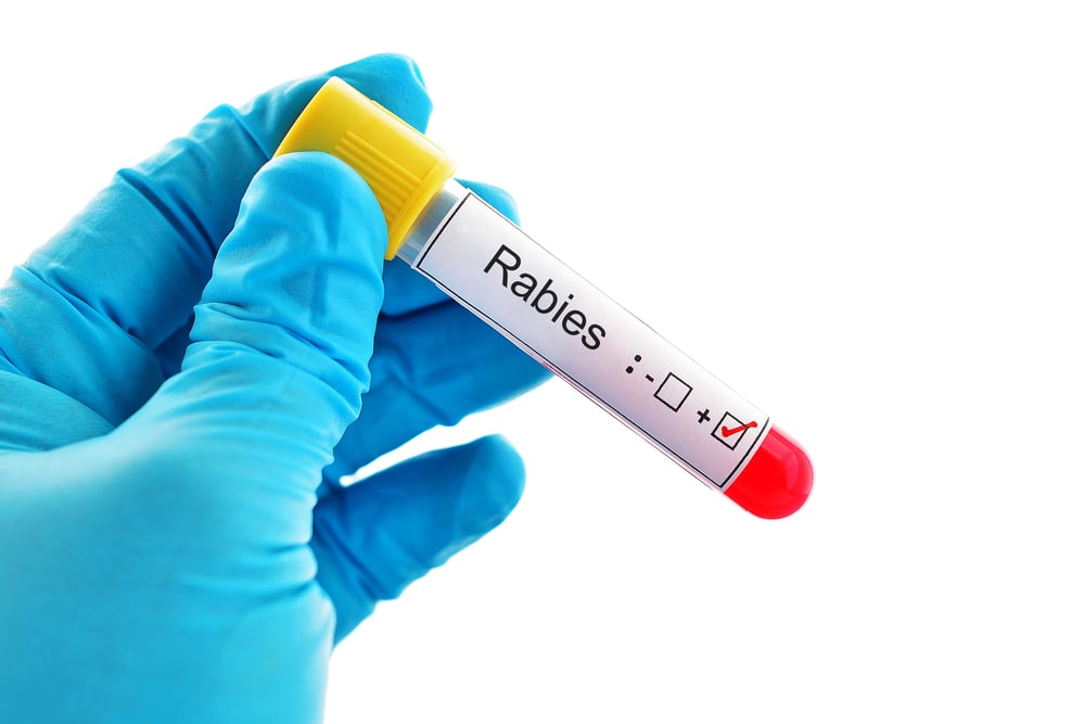 Israel anti-rabies vaccine