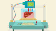 3D organ printing