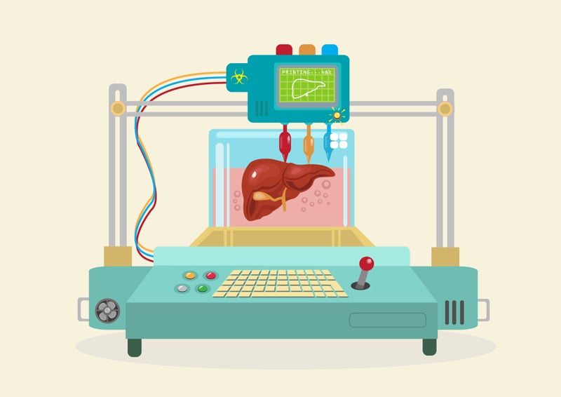 3D organ printing