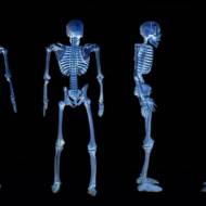 x ray skeleton