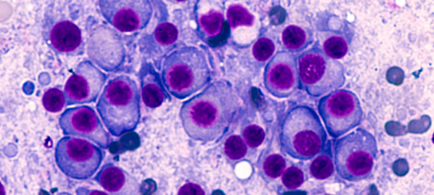 blood cancer cells