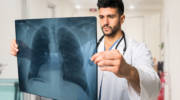 Doctor examining a lung radiography