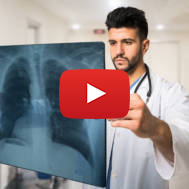 Doctor examining a lung radiography