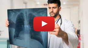 Doctor examining a lung radiography