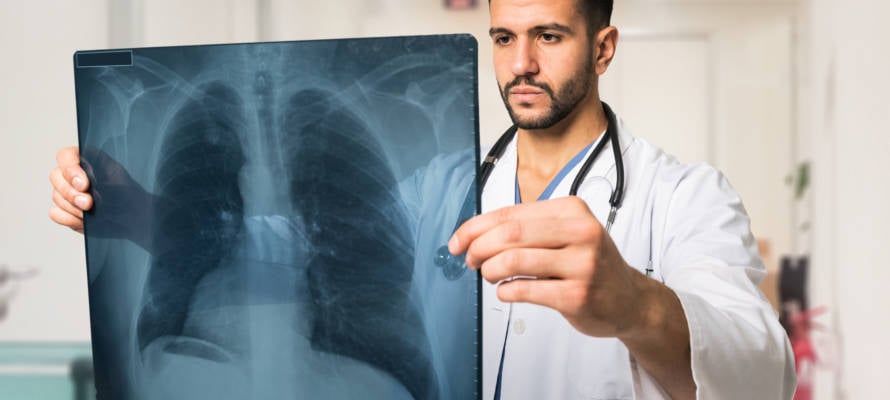 Doctor examining a lung radiography