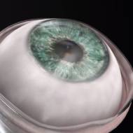 artificial cornea