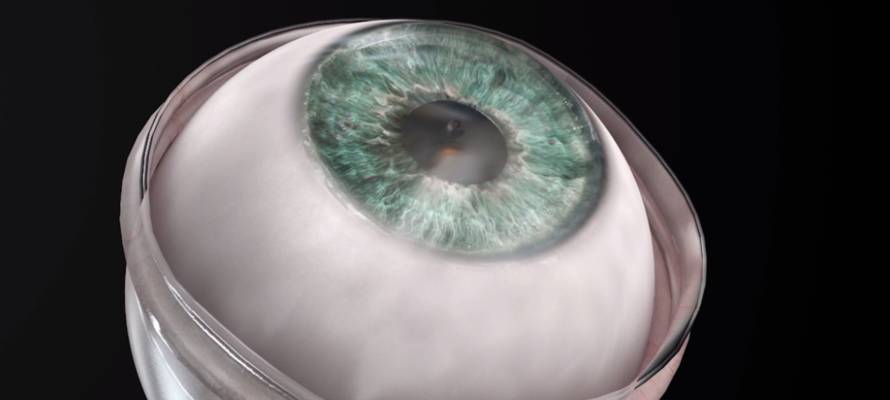 artificial cornea