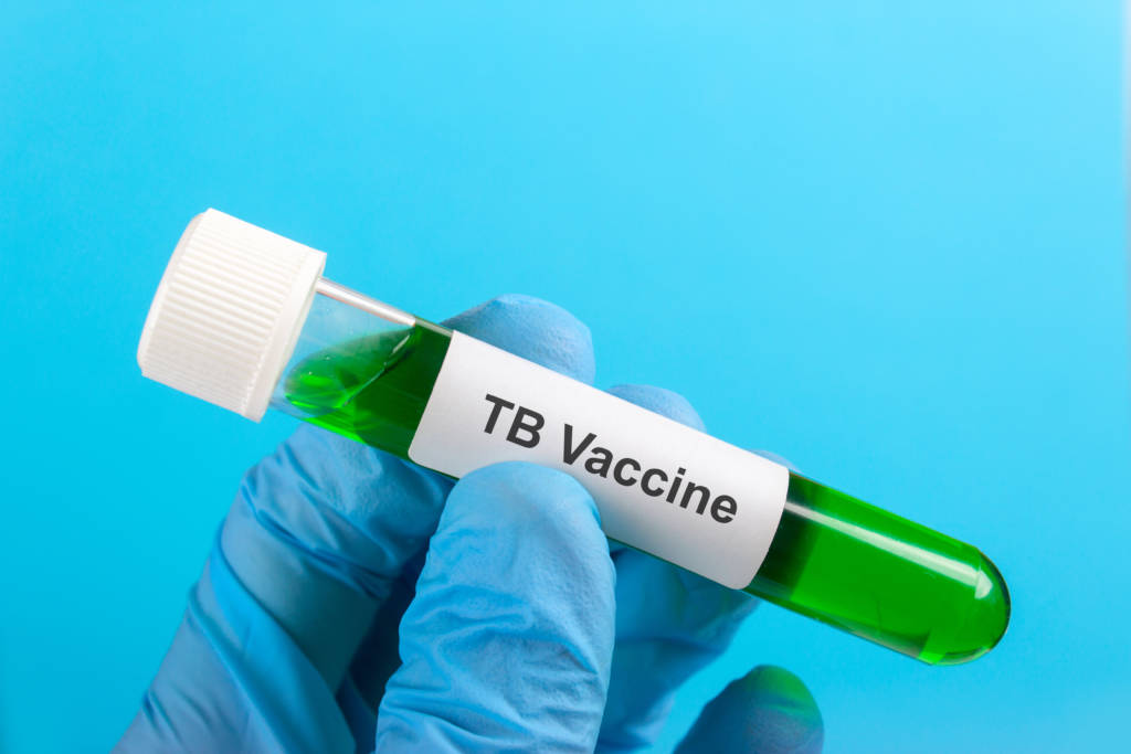 TB vaccine